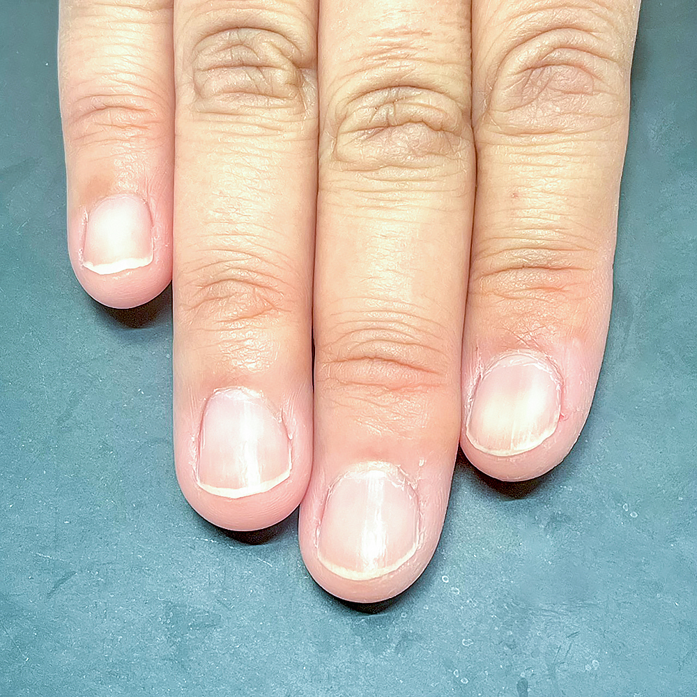 最強ネイルケア（初回の状態）Lien Nail